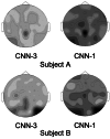 Fig. 15. Relative importance of the electrodes for signal detection in EEG using two different architectures (CNN-1 and CNN-3) and two subjects (A and B) using CNN weight visualization.