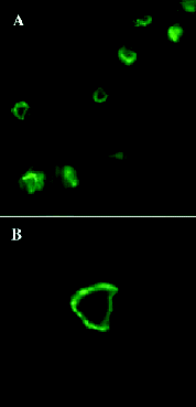 Figure 11. This image depicts isolated conjugation junctions labeled with FITC-conjugated conA.