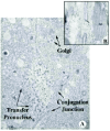 Figure 6. Transmission electron micrographs showing a fully formed conjugation junction.