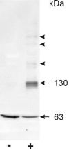 Figure 4. Western blot of ROS membrane proteins, labeled with a monoclonal antibody against the channel α-subunit (PMc 2G11).