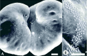 Figure 4. Scanning electron micrographs (SEMs) of fragments of V.