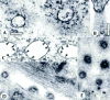 Figure 5. Transmission electron micrographs (TEMs) of cytoplasmic bridges in cleaving V.