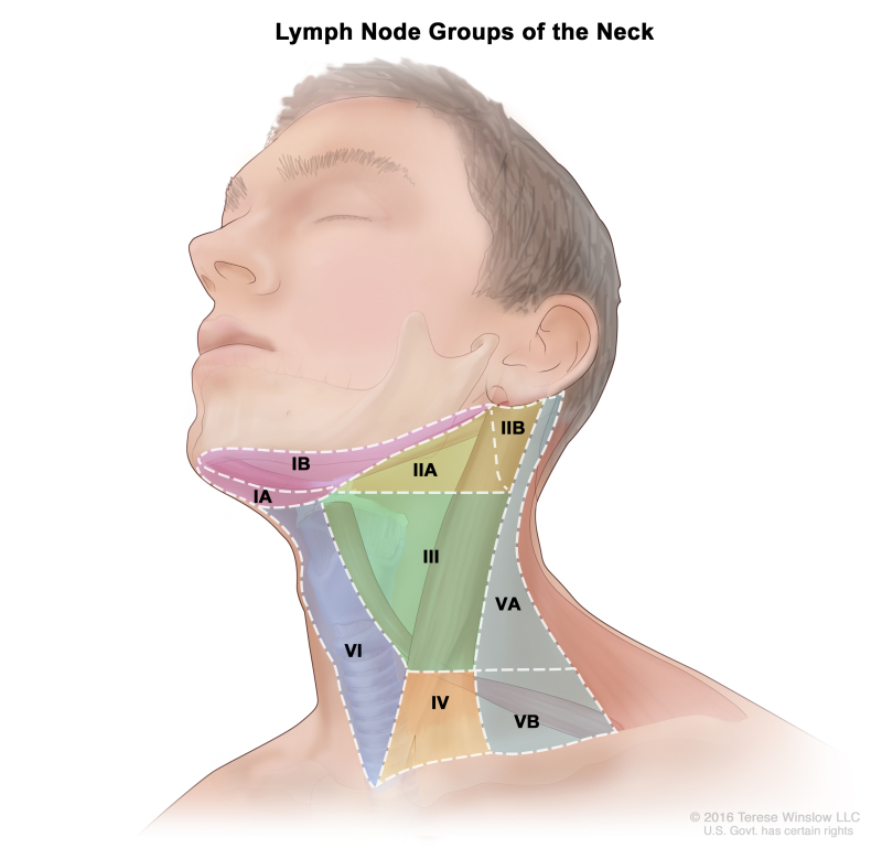 swollen lymph nodes in neck cancer