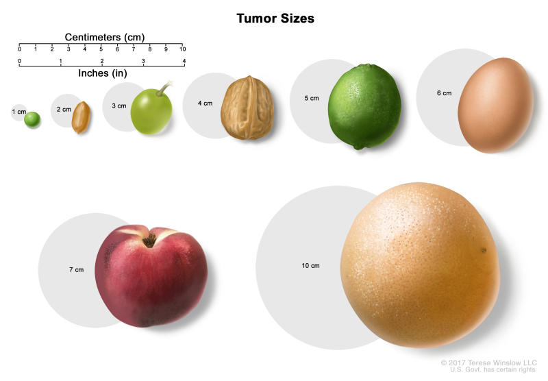 figure-tumor-sizes-are-often-measured-pdq-cancer-information