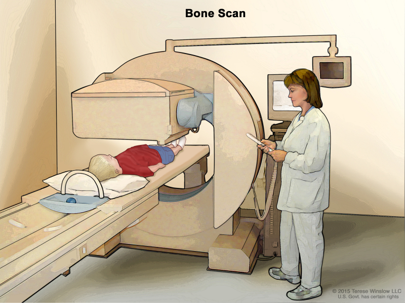 Bone scan: What does it show?