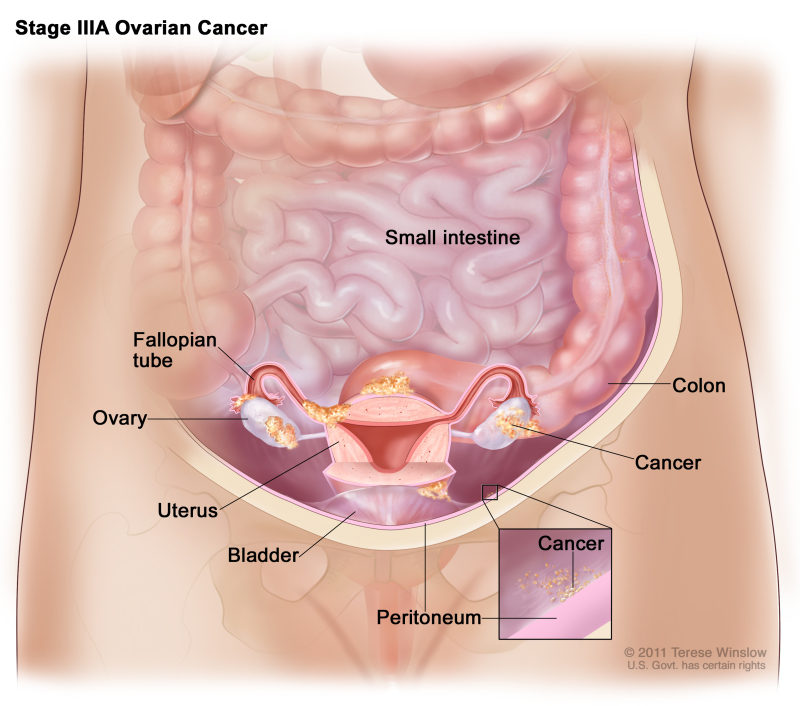 Figure, Anatomy of the female reproductive system.] - PDQ Cancer