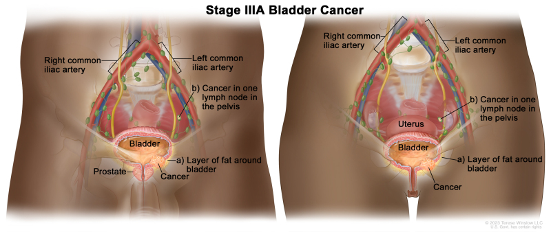 Figure, Anatomy of the female reproductive system.] - PDQ Cancer  Information Summaries - NCBI Bookshelf