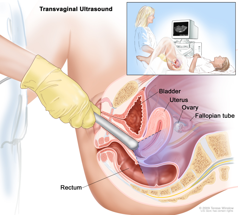 Figure, Anatomy of the female reproductive system.] - PDQ Cancer