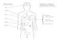 Figure 75-1. Principal tissue sites of deep mycoses in comparison to those of the superficial, cutaneous, and subcutaneous mycoses.