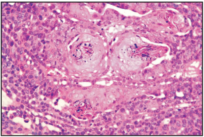 Fig. 11.26. Basaloid adenoma, mammary gland, dog.