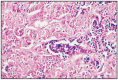 Fig. 11.31. Lobular hyperplasia, adenosis, epitheliosis, cat.