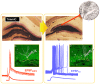 Figure 1. Sprouting of mossy fibres and formation of novel synapses that alter the operation of evoked synaptic currents.