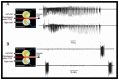 Figure 5. Recurrent seizures generated in one intact hippocampus by kainate propagate to the other hippocampus and form an epileptogenic mirror focus.