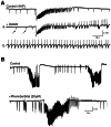 Figure 6. GABAA receptor function modulates ictal discharges in brain FCD slices.