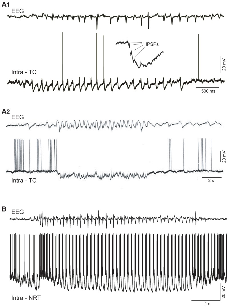 Figure 4. Intracellular correlates of TC and NRT neuron activity during spontaneous SWDs in vivo.