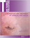 Colposcopy and Treatment of Cervical Precancer.