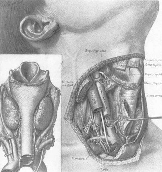 Figure 2. The normal anatomy of the neck in the region of the thyroid gland. (From Halsted WS, The operative story of goiter. Johns Hopkins Hospital Rep 19:71, 1920.)