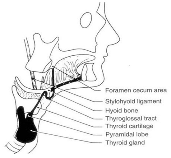 Figure 21. Diagram of the course of the thyroglossal tract. Note its proximity to the hyoid bone. (From Allard RHB: The thyroglossal cyst. Head Neck Surg 5:134–146, 1982.)