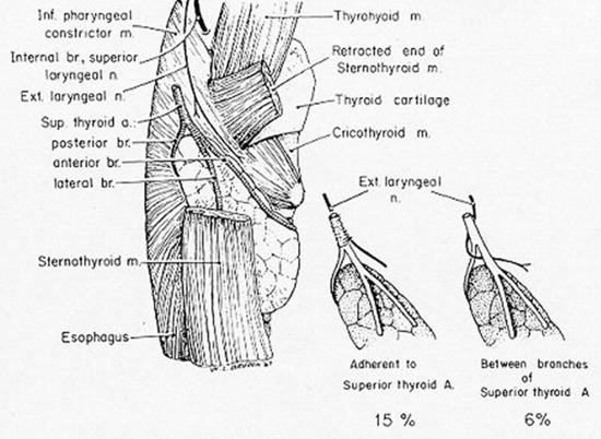 Figure 6. Proximity of the external branch of the superior laryngeal nerve to the superior thyroid vessels. (From Moosman DA, DeWeese MS: The external laryngeal nerve as related to thyroidectomy. Surg Gynecol Obstet 127:1101, 1968.)